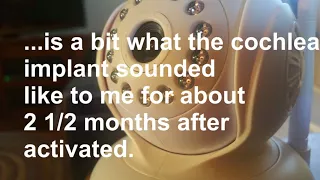 What Early Stages of Cochlear Implant Sounds Like