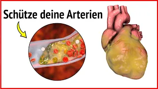 Arterien reinigen: Maximale Wirkung durch diese 4 Lebensmittel