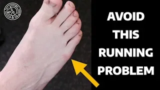 Avoid This Running Problem - Physical Therapy for Lateral Foot Pain