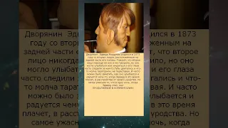 У этого мужчины было 2 лица  Но это еще не самое страшное