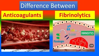 Difference between Anticoagulants and Fibrinolytics