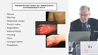 Dr. Peter Vadas - CME Presentation:  Mast Cells Gone Wild - Mast Cell Activation Disorders