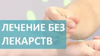 ИГЛОРЕФЛЕКСОТЕРАПИЯ   ПОЛЬЗА ИЛИ ВРЕД