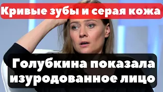 Срочно! Кривые зубы, серая кожа и заплывшие глаза: Мария Голубкина показала изуродованное лицо