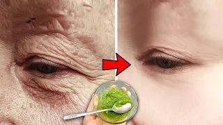 Get Rid Of Wrinkles And Dark Circles Under Your Eyes With This 3-Ingredient Mask.