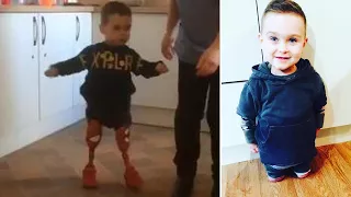 3-Year-Old Amputee Takes First Steps by Himself on Prosthetic Legs