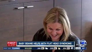 Baby beanie helps cure and prevent flat head syndrome