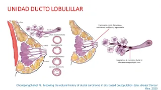 Telecapacitación 2021: Cáncer In Situ de la Mama