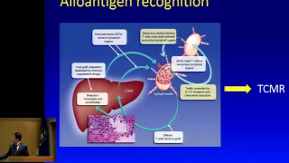 Liver Transplant Immunology