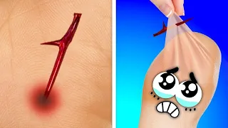 Everyday Fails Of Clumsy Doodles || Tricky Guys And Their Funny Life By Doodland