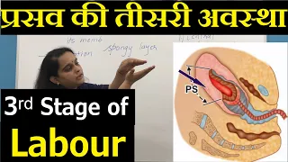 Third Stage of Normal Labour in Hindi (हिंदी )| Physiological Events & Clinical Signs in 3rd Stage