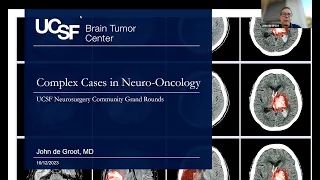 Complex Cases in Neuro-Oncology | UCSF Community Grand Rounds