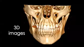 Imaging of Mandible and TMJ  Prof Dr  Mamdouh Mahfouz In Arabic