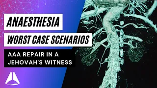 Abdominal aortic aneurysm in a Jehovah's Witness Patient | Worst Case Exam Scenarios | #anesthesia