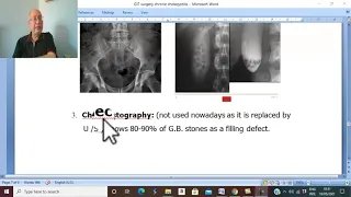 Biliary  disorders in Arabic 7 ( Chronic Cholecystitis , part 3 ) , by Dr. Wahdan