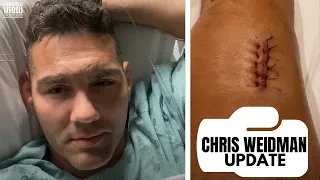 Chris Weidman Shows His Leg After Surgery from Devastating Leg Break vs. Uriah Hall at UFC 261