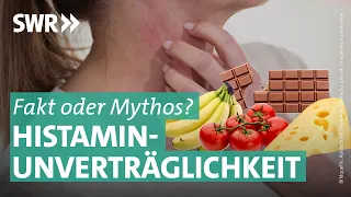 “Histaminintoleranz”: Umstrittene Krankheit | Doc Fischer SWR