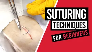 Suturing Techniques for Beginners