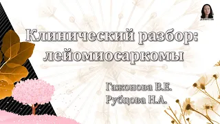 Клинический разбор - лейомиосаркомы. Проф. Гажонова В.Е., Рубцова Н.А