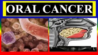 ORAL CANCER  - define , etiology , risk, pathophysiology , clinical , diagnosis , management