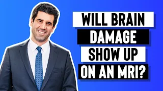 Will Brain Damage Show Up on an MRI?