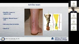 Dr. Justin Tsai - "What's New in Foot and Ankle Surgery?"