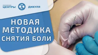 💉Метод сухой иглы: новая методика снятия болевого синдрома. Как снять болевой синдром. Дикуль. 12+