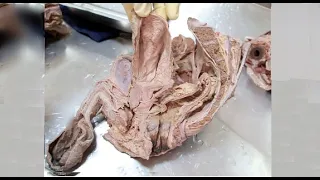 Anatomy Dissection of the Male Pelvis