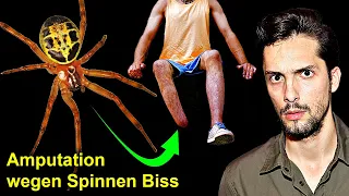 Gift-Spinne in Deutschland verursacht Amputationen | Biologe klärt auf