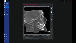 Pulling a ceph from a CBCT