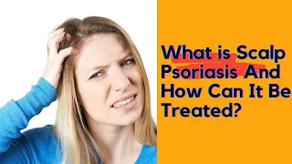 What Is Scalp Psoriasis And How Can It Be Treated? || Scalp Psoriasis Treatment