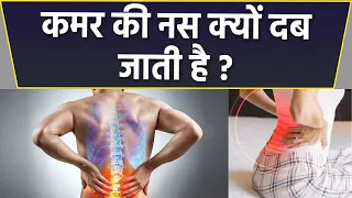 कमर की नस दबने के लक्षण | कमर की नस क्यों दब जाती है | Boldsky *health