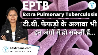 EPTB Extra Pulmonary Tuberculosis टी. बी. फेफड़ो के अलावा भी हो सकती हैं