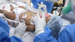 1 Year old Baby going under Anesthesia