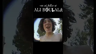 THE SCARS OF ALI BOULALA // Wer ist Ali Boulala?