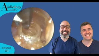EAR WAX REMOVAL COMPILATION INC FOREIGN BODY REMOVAL- EP804