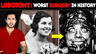 Why is LOBOTOMY The WORST Surgery in History