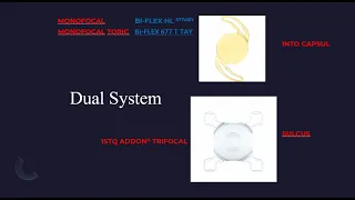 DUAL SYSTEM TORIC + ADDON TRIFOCAL ASSOC PROF LEVENT AKÇAY