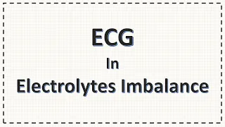 Electrolytes Imbalance and ECG changes | Hypokalemia, Hyperkalemia, Hypocalcaemia, Hypercalcaemia...