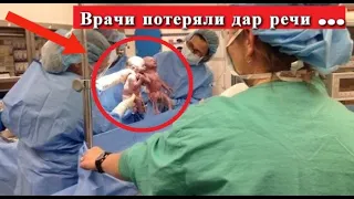 Спустя СЕКУНДЫ после РОДОВ у акушера-гинеколога ОТПАЛА челюсть, когда он увидел этих БЛИЗНЕЦОВ!