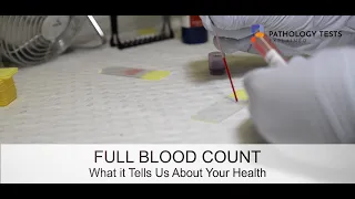 Full blood count - what it tells your doctor about your health