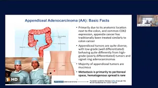Appendiceal cancer is not the same as colon cancer: Implications for chemotherapy