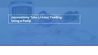 Jejunostomy Tube (J-tube) Feeding: Using a Pump