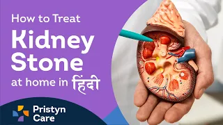 How to Treat Kidney Stones at Home in Hindi