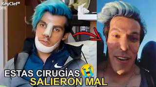 Las 10 Cirugías Plásticas de YouTubers Que Salieron Mal | Nunca Te Hagas Cirugía Plástica