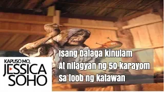 Kapuso Mo Jessica Soho"  Isang Dalaga nakitaan ng 50 karayom sa katawan at sinasabing kinulam