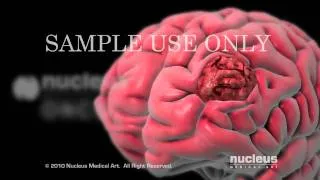 Nucleus Oncology Animation Demo (2010)