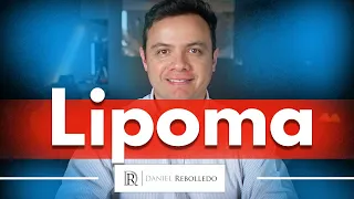 Lipoma. O Que é Lipoma? Lipoma é grave?