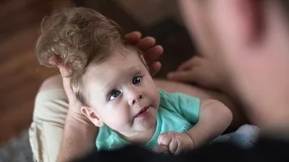 Saving Bentley’s brain: Daring surgery aims to fix a gaping hole in baby’s skull