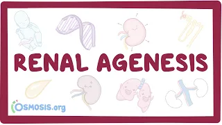 Renal agenesis (unilateral, bilateral, oligohydramnios) - causes, symptoms & pathology